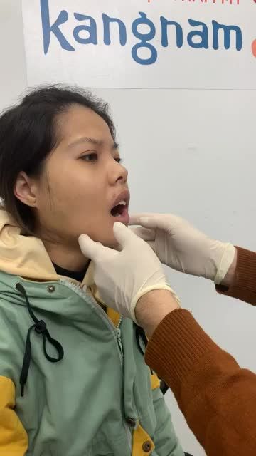 Giải cứu ca HÀM HÔ MẶT LỆCH siêu khó tại Kangnam