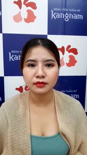 Mí tròn, rõ nếp tô điểm cho đôi mắt xinh cuốn hút