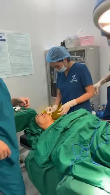 MŨI THẤP, TO, BÈ là câu chuyện không ngừng của các KH nâng mũi tại Thẩm Mỹ Tuấn Anh.