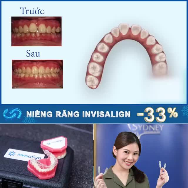 NIỀNG RĂNG INVISALIGN NHƯ THẾ NÀO