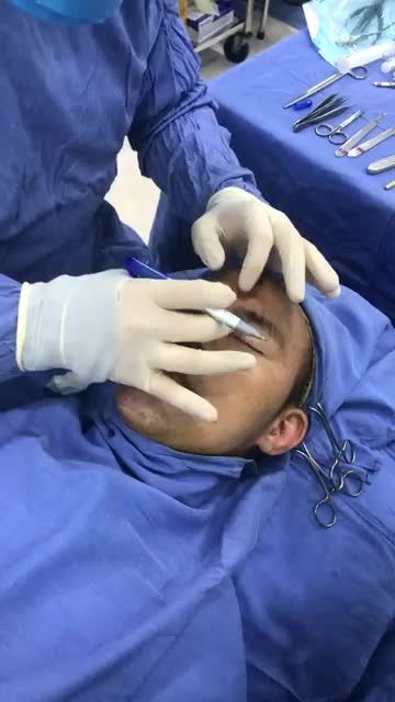 Phân tích Công nghệ Nâng mũi K Nose độc quyền tại Bv Thẩm mỹ Kangnam