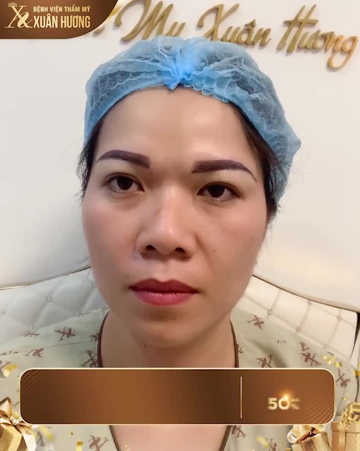 2 tuần sau là rất tự nhiên nhé moii người PHUN CHÂN MÀY SẼ BONG NHẠT TỰ NHIÊN HƠN VÀ ĐƯỜNG KHÂU SẼ HẾT NGAY SAU 5 NGÀY