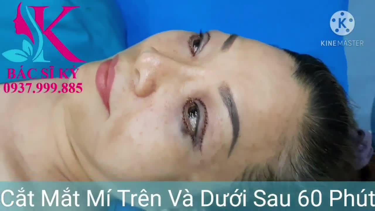 Đôi mắt là cửa sổ tâm hồn  Để có được đôi mắt đẹp hãy đến Nhà  Bs Kỳ Y Dược