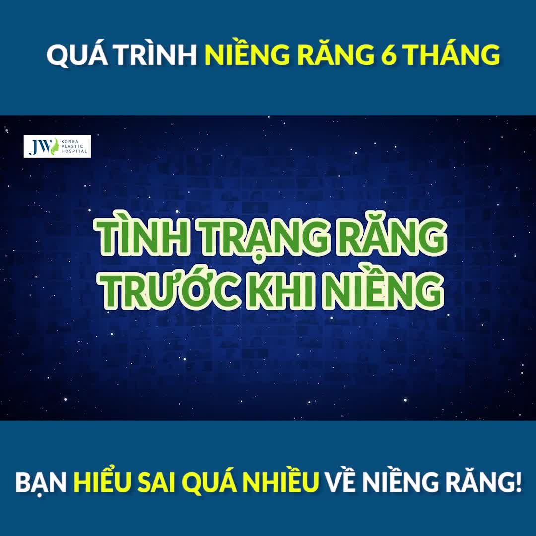Nguyễn Khôi chia sẻ tất tần tật về NIỀNG RĂNG, nghe người ta đồn dạo mà HÚ HỒN