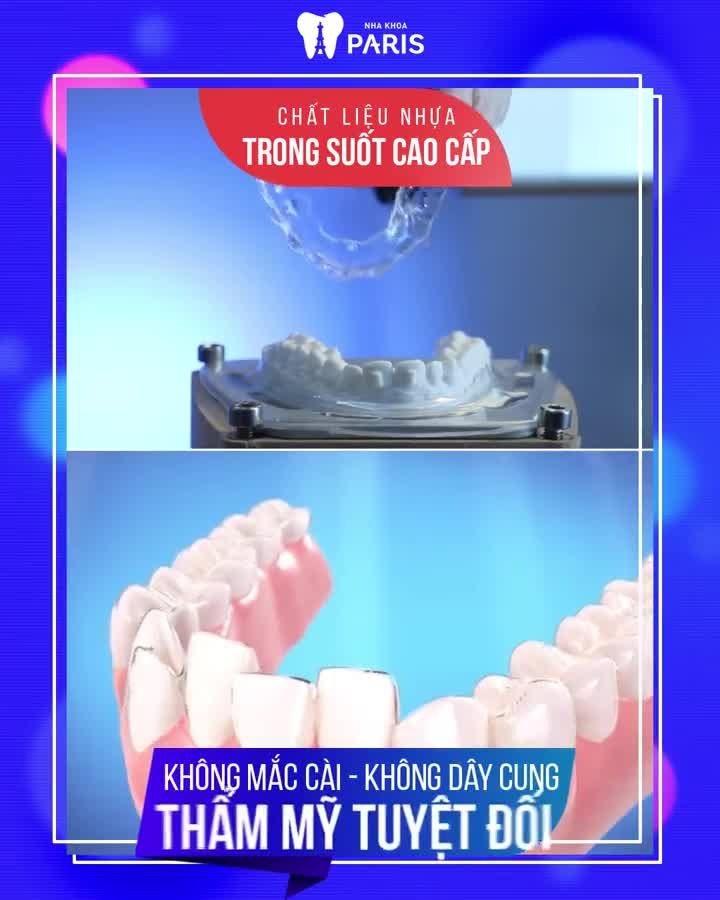 NIỀNG RĂNG THẨM MỸ CHỌN INVISALIGN