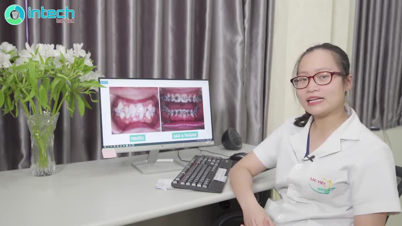 PHÂN TÍCH LÂM SÀNG CA NIỀNG RĂNG KHẤP KHỂNH THAY ĐỔI NGOẠN MỤC SAU 6 THÁNG