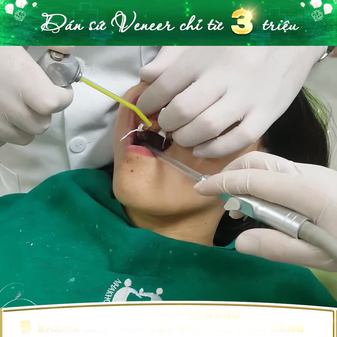 DÁN SỨ VENEER TẠI NHA KHOA GIA ĐÌNH KHÔNG BAO GIỜ LÀM BẠN THẤT VỌNG