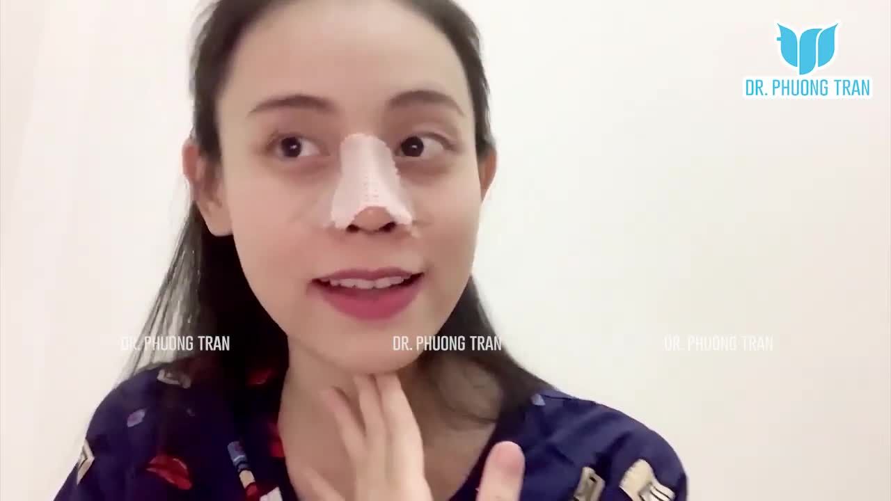 Vết thương sụn sườn chỉ như thế này sao?
