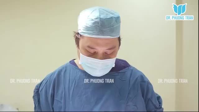 THEO DÕI BÁC SĨ NÂNG MŨI SỤN SƯỜN TOÀN PHẦN CHO KHÁCH HÀNG MŨI NGẮN, SỐNG LUNG LAY