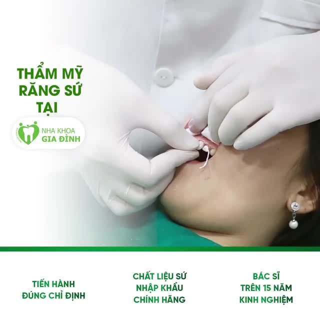 THẨM MỸ RĂNG TẠI NHA KHOA GIA ĐÌNH