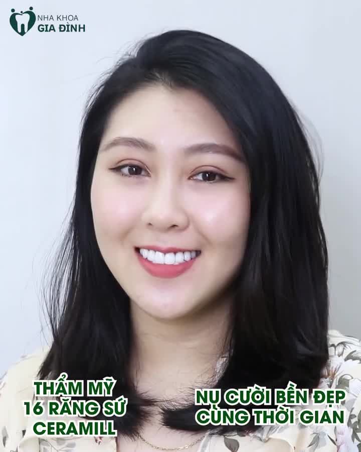CƯỜI ĐẸP CÙNG THỜI GIAN VỚI THẨM MỸ RĂNG SỨ CAO CẤP