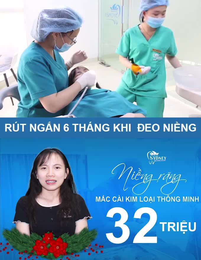 CHỈNH NHA HOÀN HẢO VỚI NIỀNG RĂNG MẮC CÀI KIM LOẠI TỰ BUỘC