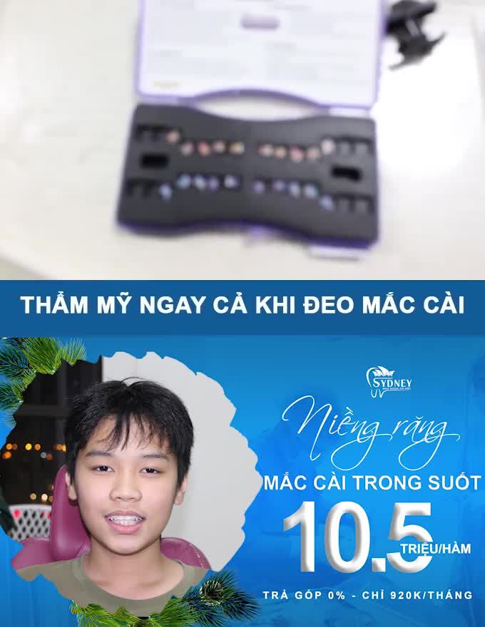 CƯỜI SẢNG KHOÁI CÙNG MẮC CÀI PHA LÊ