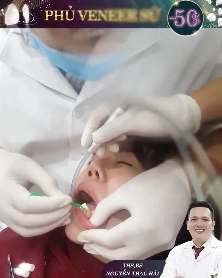 THẨM MỸ RĂNG: TRẺ GƯƠNG MẶT SÁNG NỤ CƯỜI