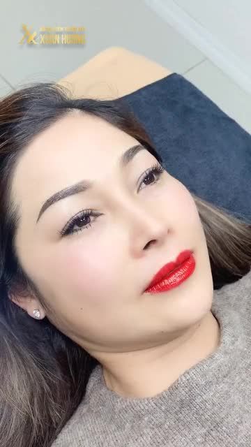 COMBO PHUN MÀY MÔI ĐẸP XUẤT SẮC NGAY SAU KHI THỰC HIỆN TẠI BVTM XUÂN HƯƠNG