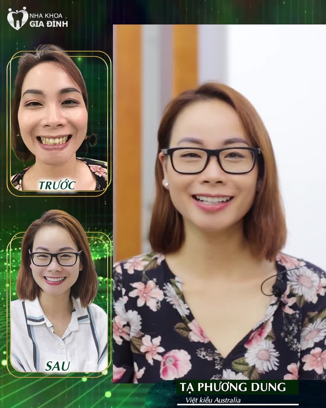 NHA KHOA GIA ĐÌNH DẪN ĐẦU XU HƯỚNG VIỆT KIỀU VỀ NƯỚC LÀM RĂNG