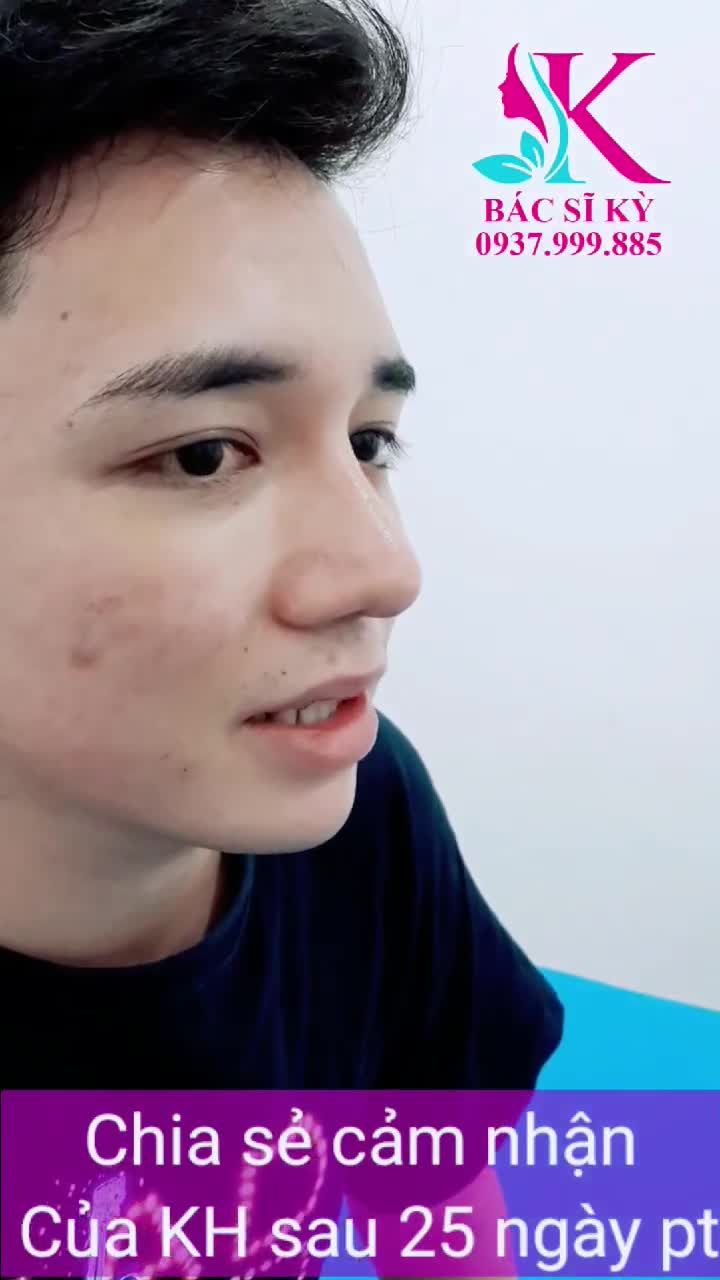 Bạn khách hàng chia sẻ cảm nhận nâng mũi hết sức chân thực !