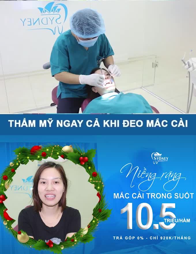 ĐỐI TƯỢNG NÊN NIỀNG RĂNG MẮC CÀI TRONG SUỐT
