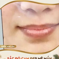 NẮNG LÊN CHO MÁ EM HỒNG CHO MÔI EM ĐỎ NGỌT NỒNG YÊU THƯƠNG