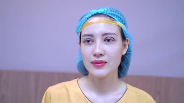Dr.Hải Lê tiếp tục giải cứu thành công ca Mí lỗi hỏng do thực hiện tại cơ sở không uy tín dẫn đến hệ lụy về thẩm mỹ cũng như biến chứng về sức khỏe đôi mắt.