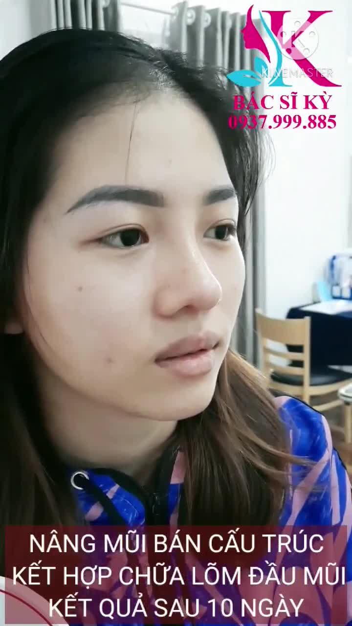 Lời khuyên dành cho bạn: HÃY LỰA CHỌN BS CÓ CHUYÊN MÔN CAO VÀ CƠ SỞ THẨM MỸ UY TÍN ĐỂ LÀM ĐẸP AN TOÀN