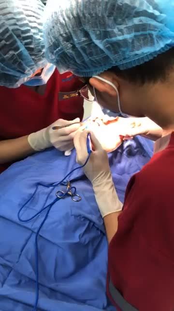 Cánh mũi dày mỏng nên cuộn cánh mũi hay cắt cánh mũi?