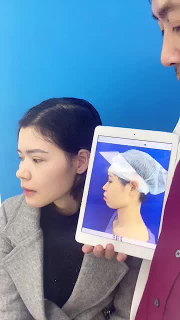 Hết HÔ sau 1 tháng phẫu thuật  cùng đón xem kết quả