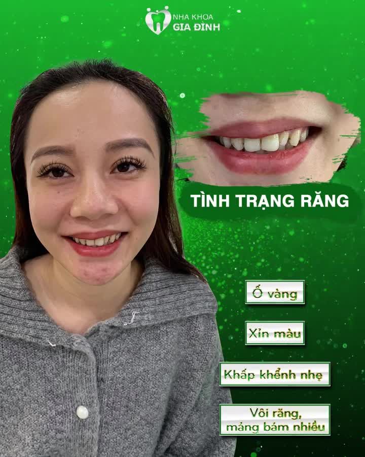 ĐIỂM TÔ NỤ CƯỜI DỊP CUỐI NĂM CÙNG NHA KHOA GIA ĐÌNH