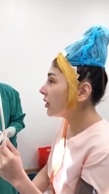 Bác sĩ Sơn Tùng và dáng mũi cấu trúc Sline xuất sắc