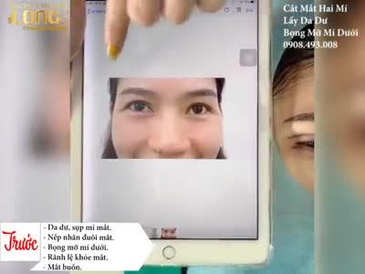 Bạn có thích sở hữu một đôi mắt đẹp? mắt đẹp không khó khi đến trung tâm chúng tôi