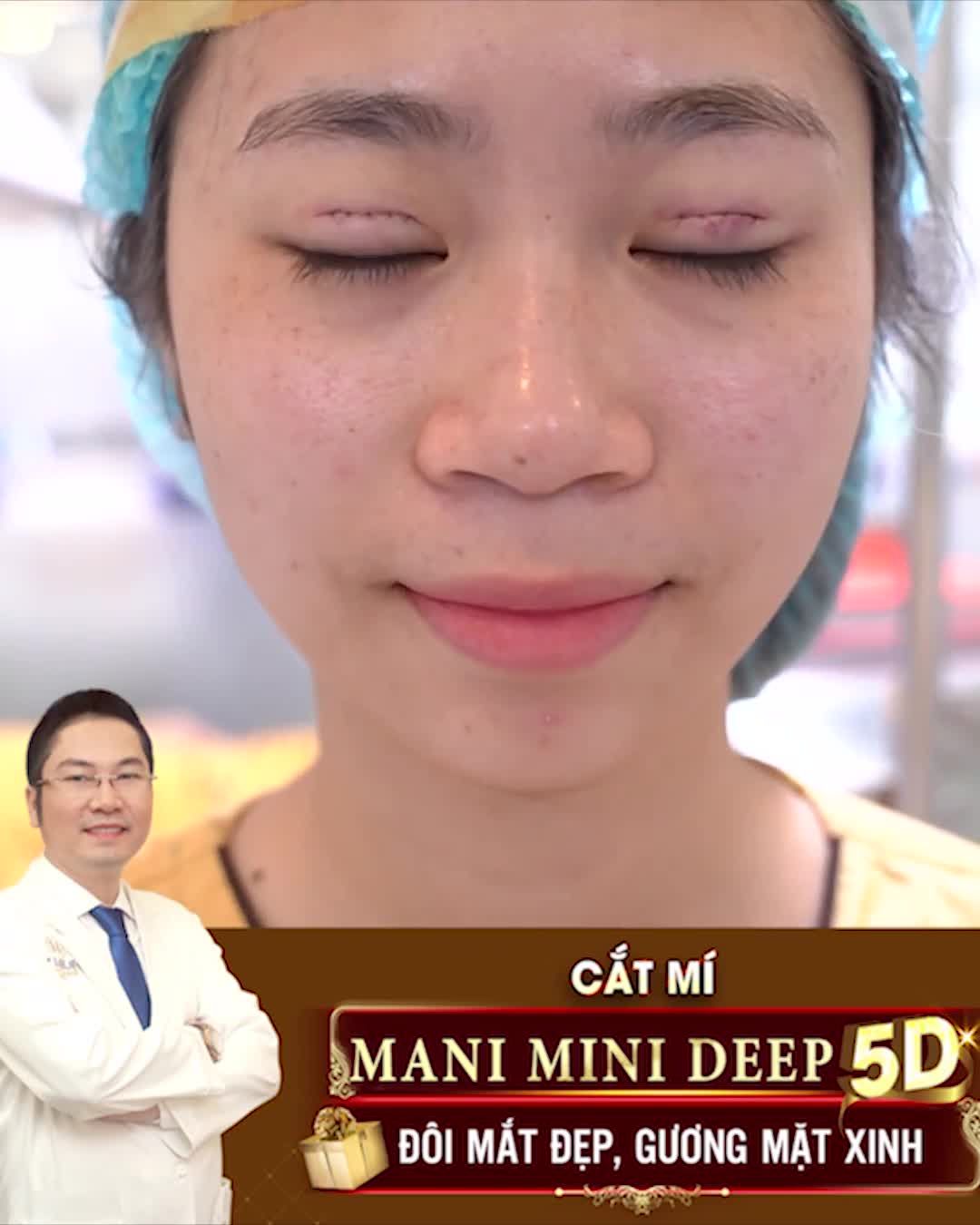 CẮT MÍ MANI MINI DEEP 5D  ĐÔI MẮT ĐẸP, GƯƠNG MẶT XINH.!