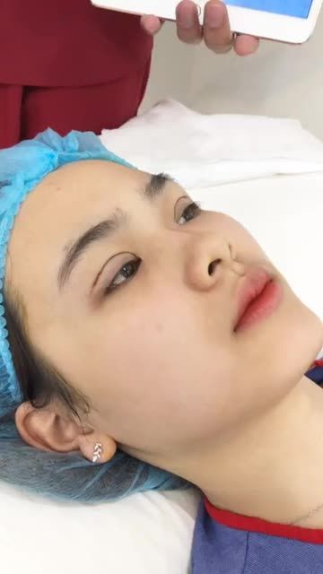 Chia sẻ bí quyết có MẮT 2 MÍ TO TRÒN TỰ NHIÊN Không phẫu thuật