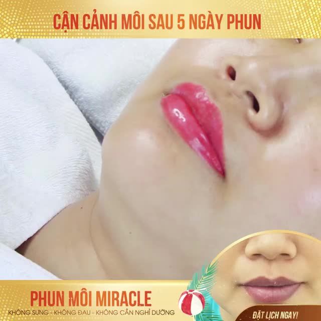 CHIÊM NGƯỠNG KẾT QUẢ PHUN MÔI SAU 5 NGÀY TẠI XUÂN HƯƠNG