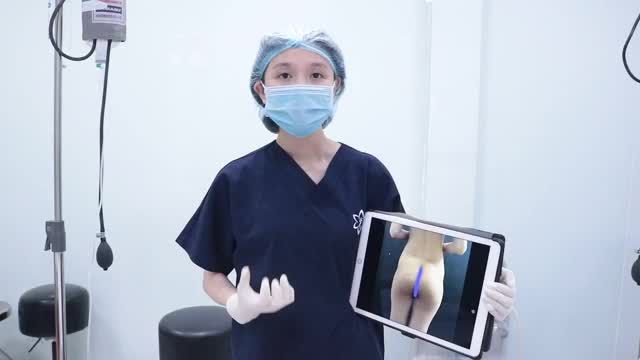 ĐÂY LÀ CÁCH BÁC SĨ BỆNH VIỆN EMCAS NÂNG MÔNG BẰNG PHƯƠNG PHÁP ĐẶT TÚI KẾT HỢP CẤY MỠ TỰ THÂN