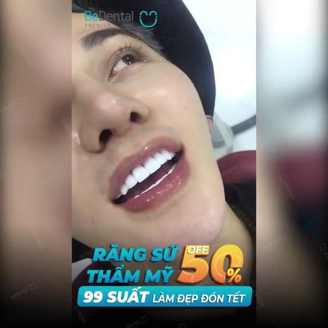 Kết quả thẩm mỹ 20 răng sứ của khách hàng Minh Phong tại Bedental đẹp quá mĩ mãn luôn