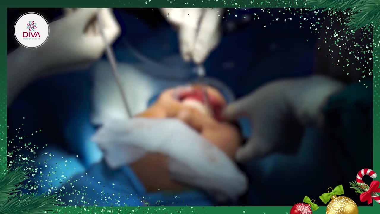 LẤY TÚI MỠ MÁ: MẶT THON GỌN, VLINE, GIẢM CHẢY XỆ