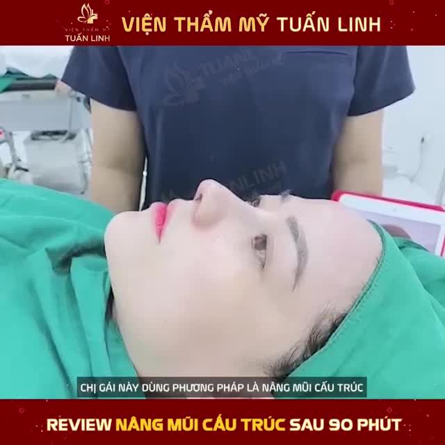 Nâng mũi cấu trúc sau 90 Phút phẫu thuật...