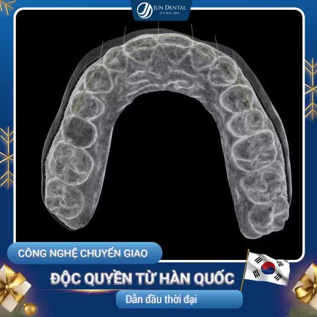 SAU 48H CÓ NGAY RĂNG XINH KỊP DIỆN TẾT  NHANH CHÓNG, AN TOÀN  BỀN CHẮC TRỌN ĐỜI