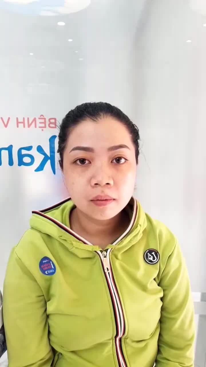 Hở lợi cười kém duyên Chọn dịch vụ kéo dài thân răng tại Kangnam