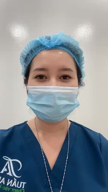 Loại bỏ mắt 1 mí sau 30’.