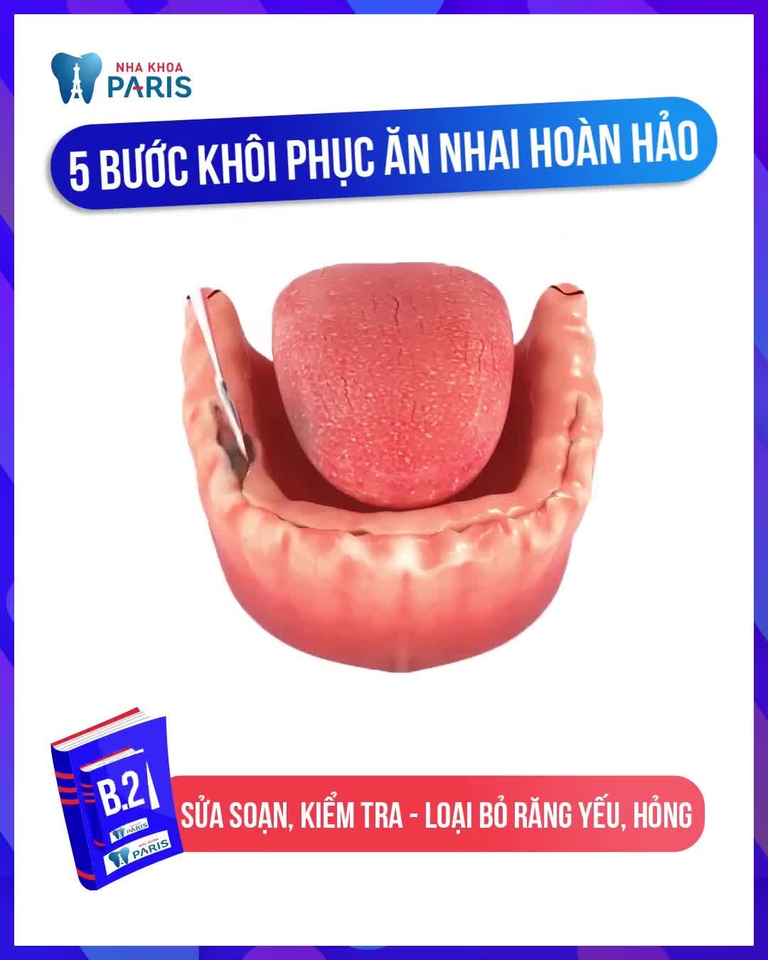 MẤT CẢ HÀM RĂNG  ĐÃ KHÔNG CÒN LÀ NỖI LO