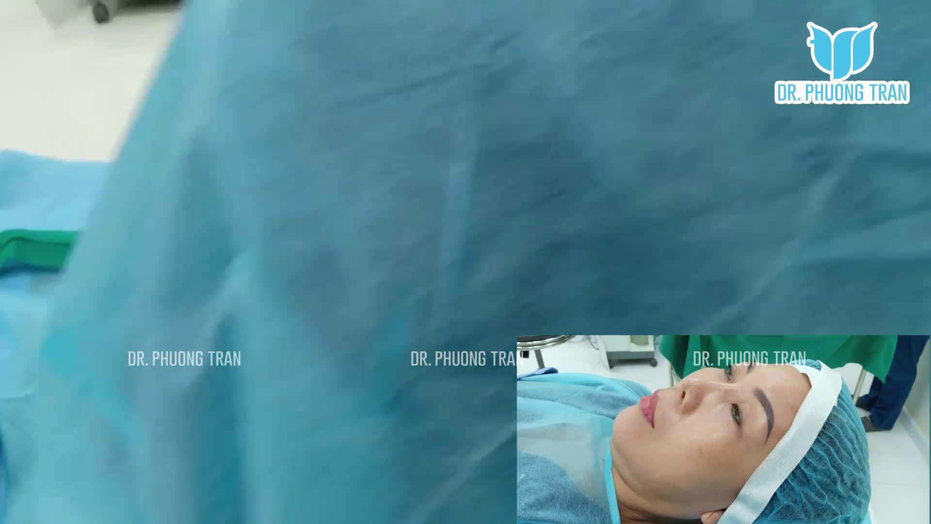 Ca mũi quá ít sưng bầm nhờ gây tê lạnh