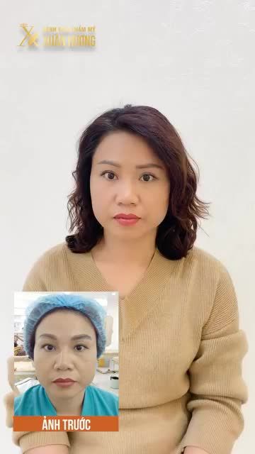 REVIEW CHÂN THỰC SAU 3 THÁNG THỰC HIỆN COMBO DỊCH VỤ NÂNG CUNG MÀY PHUN THÊU THẨM MỸ TẠI BVTM XUÂN HƯƠNG