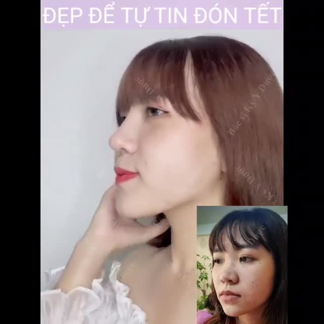 Bạn đã sẵn sàng cho chuyến  lên đời nhan sắc của mình chưa
