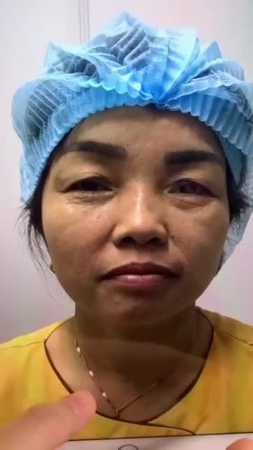 Lấy lại 10 năm thanh xuân nhờ thẩm mỹ mắt bạn có tin điều này? Theo dõi video sau đây để có câu trả lời