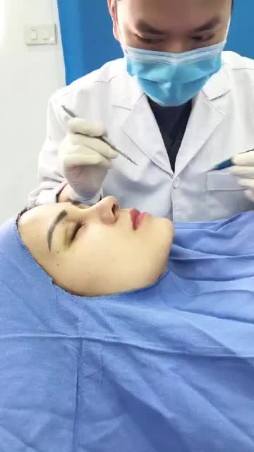 Gặp lại bạn nữ sau 10 ngày nâng mũi cấu trúc 4D và cắt mí Plasma