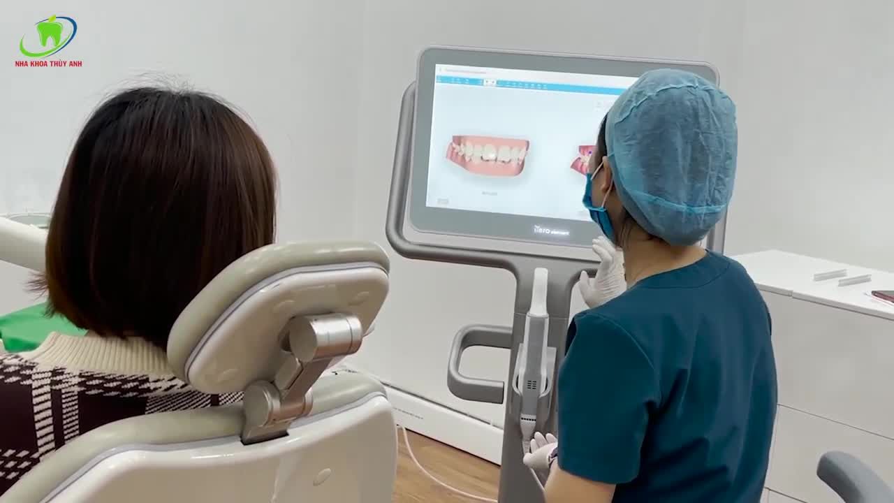 TẶNG 30 SUẤT THAM DỰ NGÀY HỘI NIỀNG RĂNG INVISALIGN
