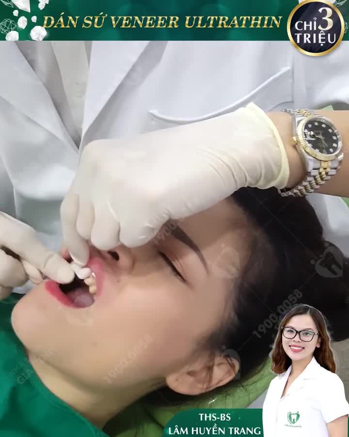 DÁN SỨ VENEER SIÊU MỎNG ƯU ĐÃI ĐẾN 50% NHA KHOA GIA ĐÌNH DẪN ĐẦU XU HƯỚNG THẨM MỸ RĂNG BỀN ĐẸP, CHẮC KHOẺ