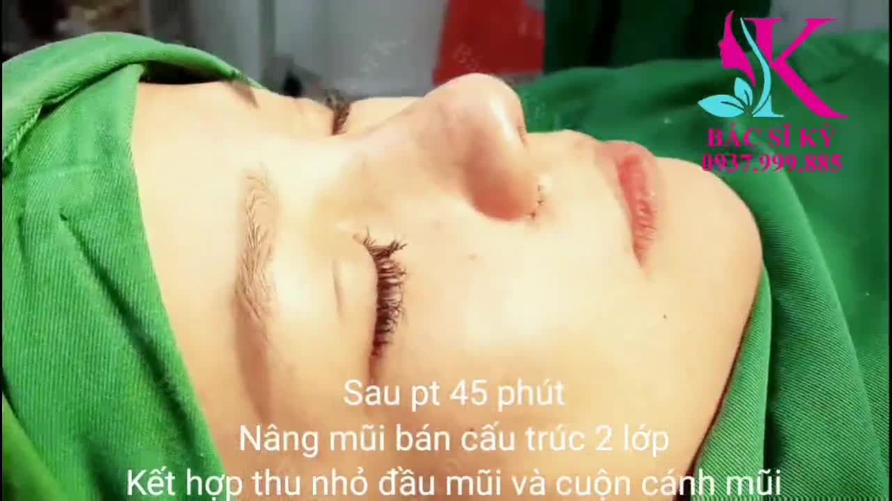 LÀM ĐẸP ĐÓN TẾT Giai đoạn chạy nước rút