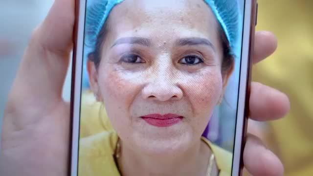 Mắt sụp mí che khuất tầm nhìn, ảnh hưởng đến độ linh hoạt của đôi mắt ở tuổi U40++ phải làm sao?